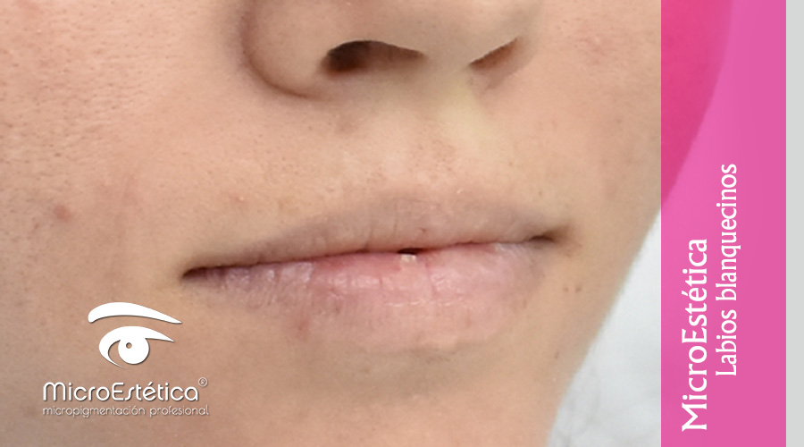 labios blanquecinos